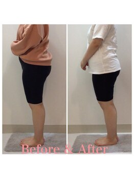 スタイルラボ高松/産後骨盤矯正の効果♪