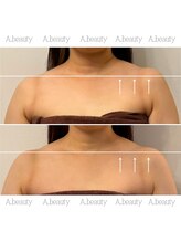 エービューティ(A.beauty)/ゆがみが綺麗に♪