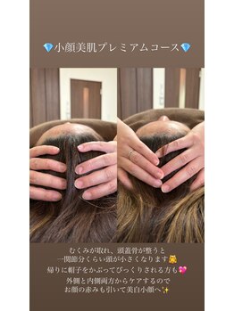 ジャスミン(Jasmine)/頭蓋骨小顔矯正