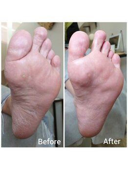 リゼラアンドコー 上越店/ドイツ式フットケア専門店