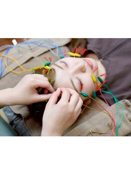 鍼灸施術を受けたい