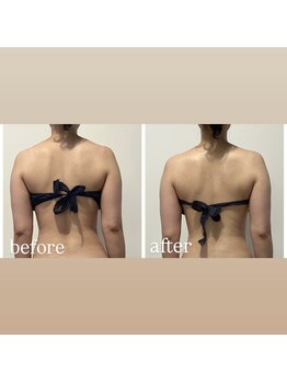 ブルーム(bluem)/Newオプション＆商品導入★