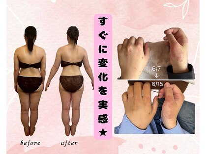 ヨサパーク オハナ(YOSA PARK ohana)の写真