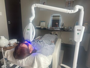 セルフダック 宮城角田店(SELFDUCK)/ホワイトニングの様子