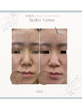 プティリッシュ(Petit Rishe)/ハイドロヴィーナス