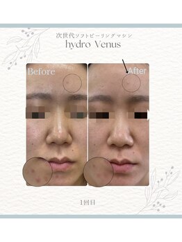 プティリッシュ(Petit Rishe)/ハイドロヴィーナス