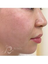 ベルメイク(BELLE MAKE)/リベル☆1日目