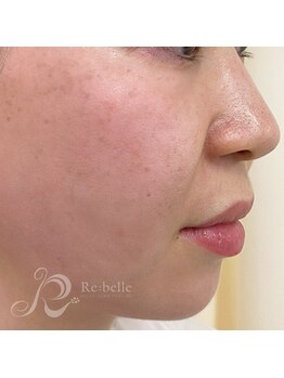 ベルメイク(BELLE MAKE)/リベル☆1日目