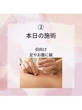 リローゼ(Re.ROSE)/仰向けになり必要箇所は鍼