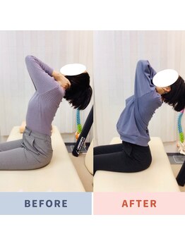 ナオル整体 三鷹院(NAORU整体)/20代女性施術事例【胸椎伸展】