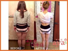 痩身館アヤ(aya)/耳つぼダイエット【富山/痩身】