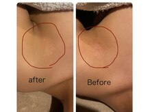 インチャント(enchant)/ボディのケアも。お任せ