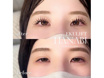 ハナビ ナミキ(HANABI NAMIKI)の写真