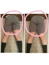 アクア(AQUA)/O脚矯正