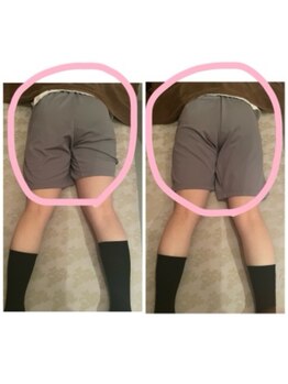 アクア(AQUA)/O脚矯正