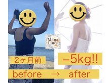 マナリノ(Mana Lino)/ブライダルエステ♪