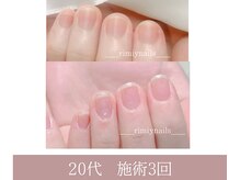 rimiy式!根本改善したい方！お爪が別人の様に変化◎解消できます