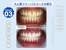 ハク 袋井磐田店(HAKU)/お客様before→after 3
