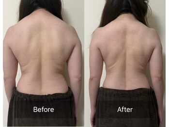 天使の艶肌 武蔵小杉店/ブライダルエステ姿勢改善