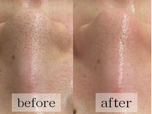 グランビューティ(Glanz Beauty)/20代女性