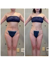 エクセレントビューティーサロン 艶(EN)/サブスク8.5KG減量