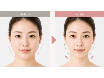 いつき整体院の写真/小顔、フェイスラインを見て触って変化を感じられます！！！
