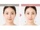 いつき整体院の写真/小顔、フェイスラインを見て触って変化を感じられます！！！
