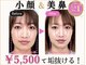 隆鼻矯正専門店 ラプリ(Raplit)の写真