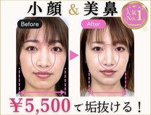隆鼻矯正専門店 ラプリ(Raplit)