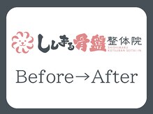 ししまる骨盤整体院 一宮院/【Before→After】