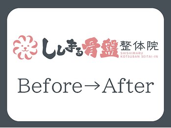 ししまる骨盤整体院 一宮院/【Before→After】