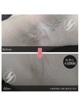 グリッター(glitter)/