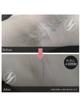 グリッター(glitter)/