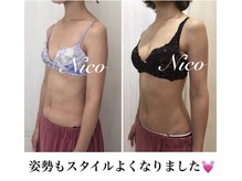 ニコ 岐南本店(Nico)/バスト★before→after