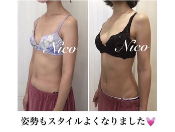 ニコ 岐南本店(Nico)/バスト★before→after