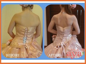 痩身館アヤ(aya)/耳つぼダイエット【富山/痩身】