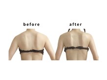 リカバリー(&recovery)/肩甲骨剥がし/骨洗浄リンパ