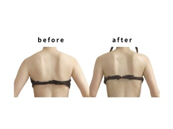 リカバリー(&recovery)/肩甲骨剥がし/骨洗浄リンパ