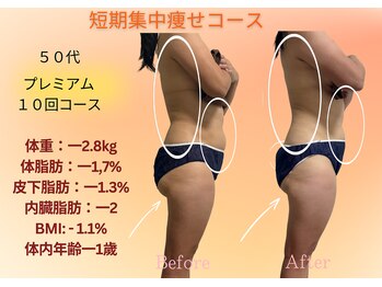 ヨサパーク リボーン(YOSA PARK Reborn)/劇的ビフォーアフター/痩身駒込