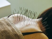 鍼処シラカワ なごや院千種(鍼処SHIRAKAWA)