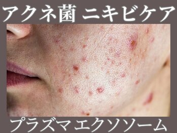 【肌管理×小顔・毛穴改善フェイシャルサロン】MavY.塚口店【3月 NEW OPEN(予定)】/ニキビケアにはプラズマ滅菌！