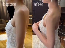 アモリール(Amolir)/巻き肩や猫背も美しく！