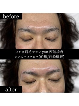 ユー 西船橋店(you)/ビフォーアフター写真
