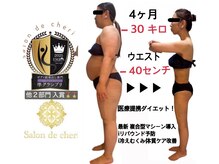 サロンドシェリ エステ(Salon de cheri)