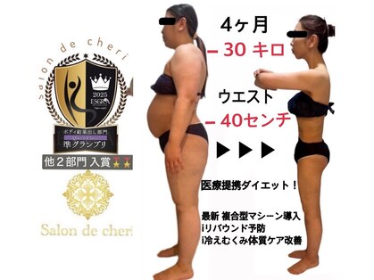 サロンドシェリ エステ(Salon de cheri)の写真