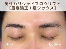 リルト(Re:lut)/男性ハリウッドブロウリフト