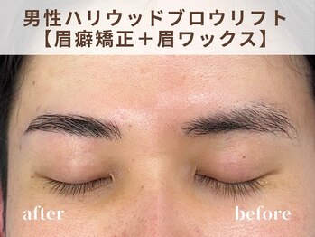 リルト(Re:lut)/男性ハリウッドブロウリフト