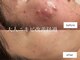 アルフォービューティー 恵比寿店(ALU for beauty)の写真