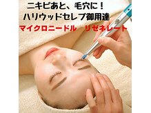 アクネ菌ケア専門サロン ベネーブ 武蔵小杉店