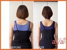 痩身館アヤ(aya)/耳つぼダイエット【富山/痩身】